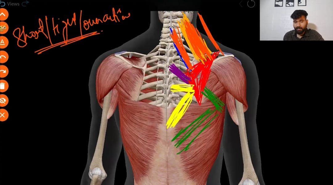 3D anatomy model highlighting shortened and tight upper back muscles